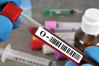 0, A, B, AB kan grubu nasıl beslenmeli? Bu yiyeceklerden uzak durun