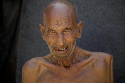 Gazzede son 3 haftada 1000 yetişkin açlık nedeniyle hastanelik oldu