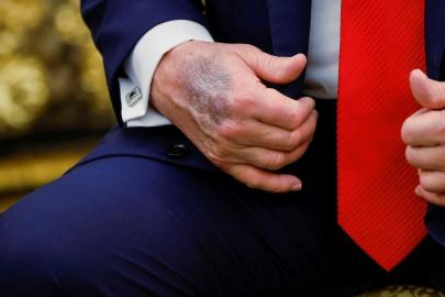 Trump'ın eli yine gündem oldu, Beyaz Saray'dan açıklama geldi