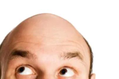 İki Popüler İçecek Saç Dökülmesi ve Erken Beyazlamayı Tetikliyor